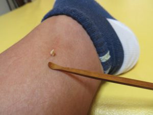 耳かきと比べてみました