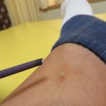 時代劇で見るお灸と【ゆうこん堂】で使うお灸は大きく異なります