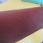 心房細動から復活、ランニング生活満喫してます