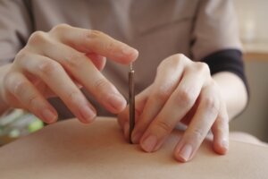 身体全体を鍼灸施術