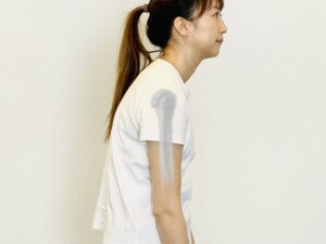 巻き肩・ストレートネック・猫背・反り腰・O脚・X脚などの姿勢矯正にも鍼灸を